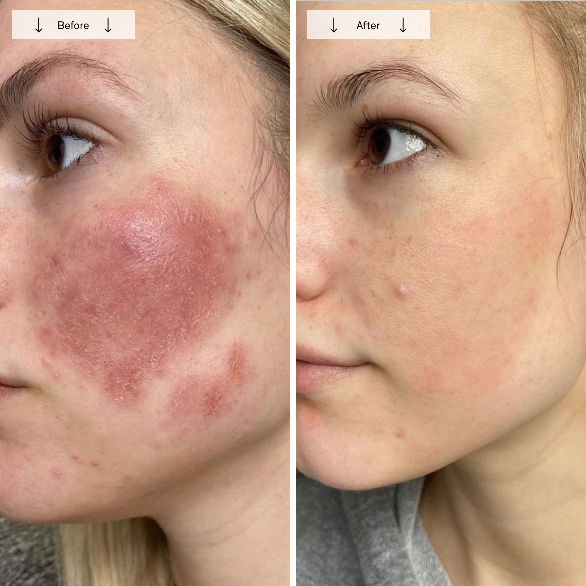 Omnilux Contour Face - Image 12
