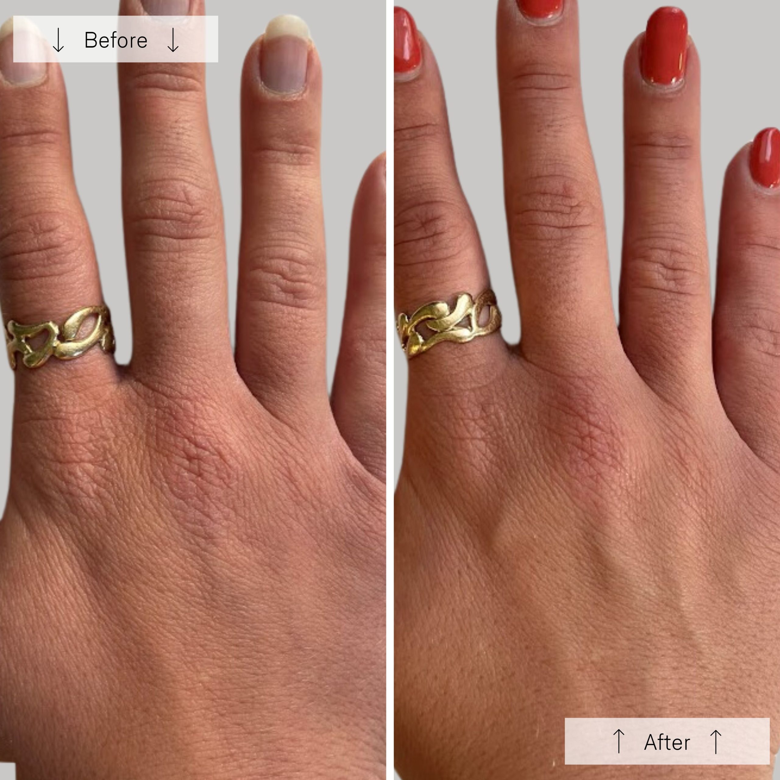 Omnilux Contour Glove - Image 9