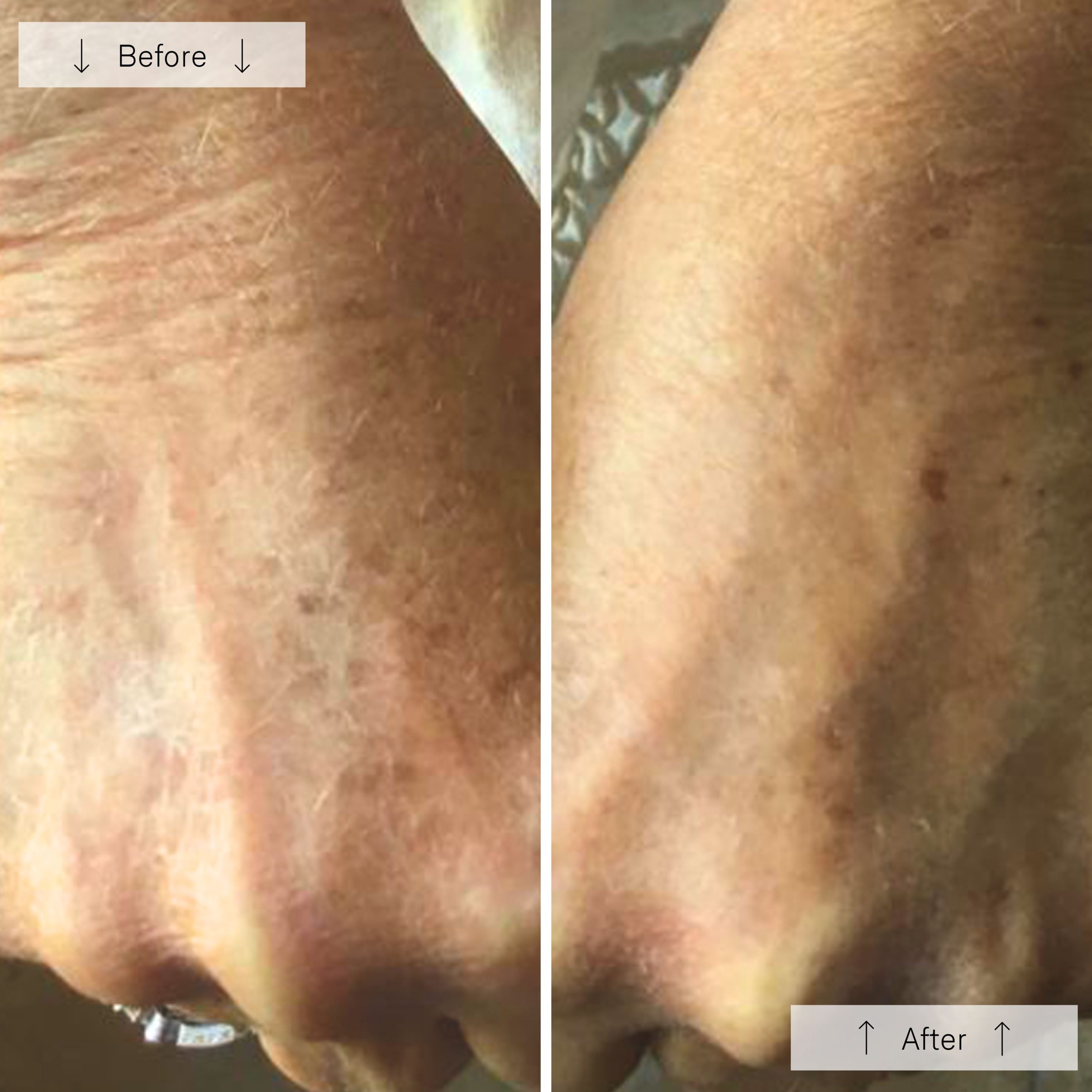 Omnilux Contour Glove - Image 11