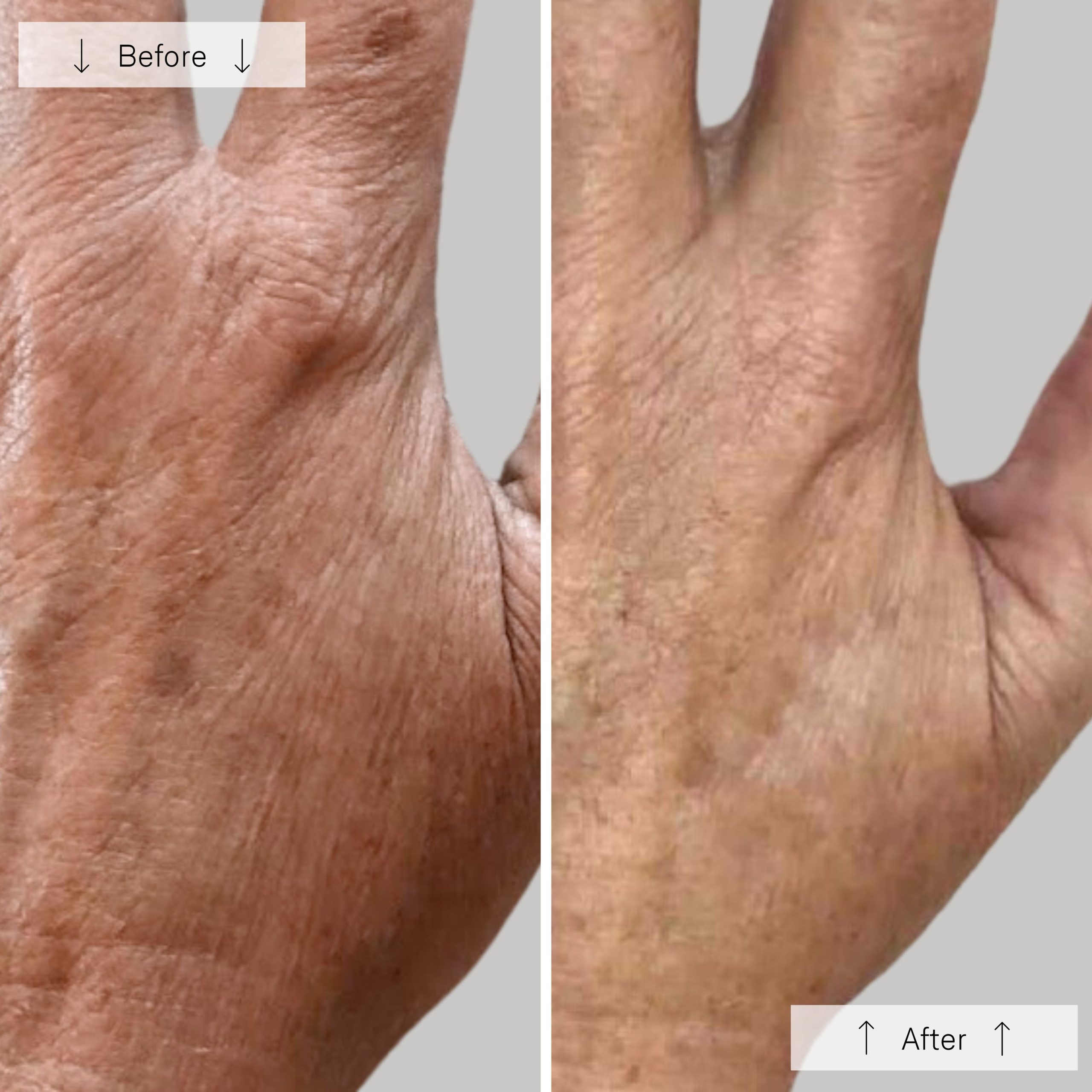 Omnilux Contour Glove - Image 12