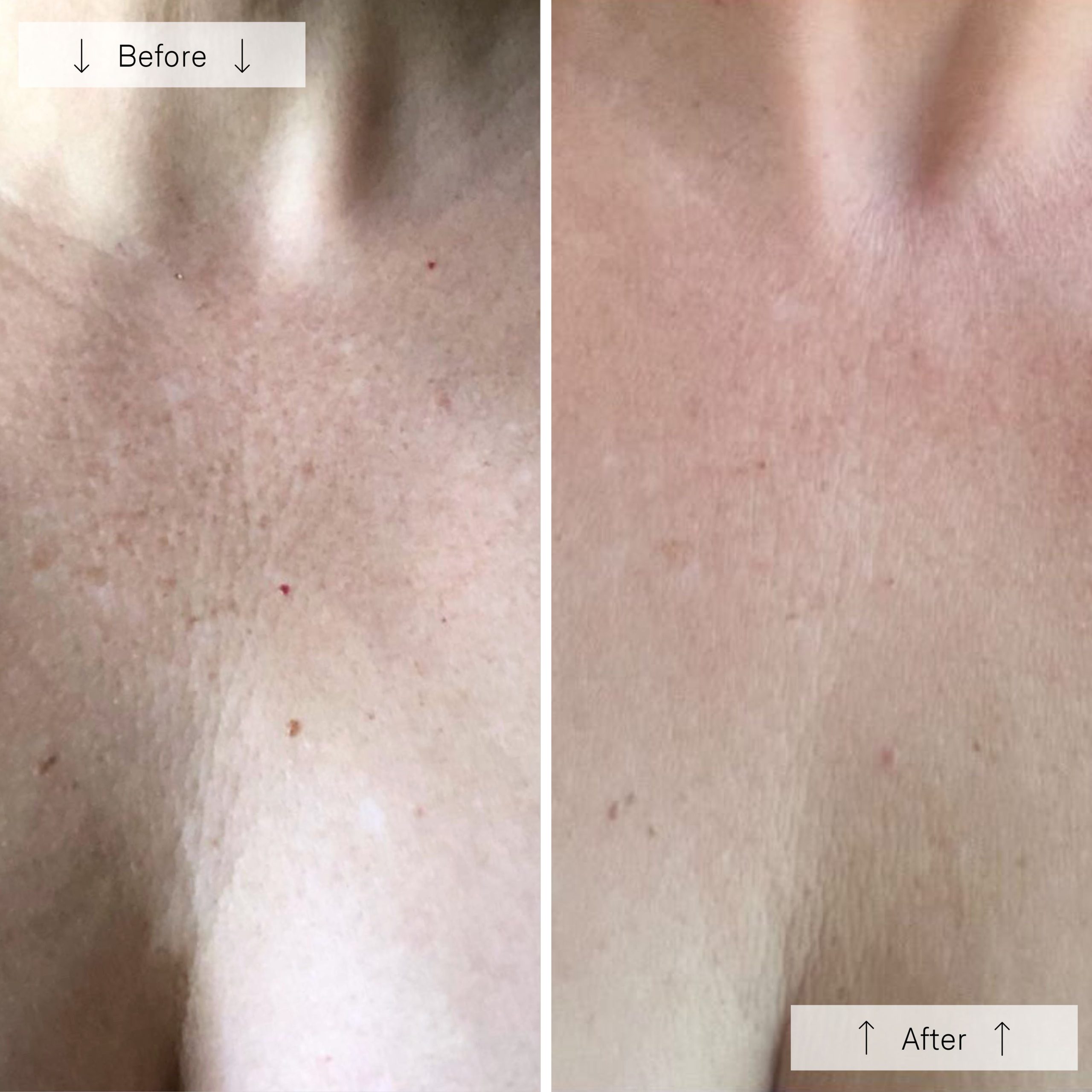 Omnilux Contour Neck & D??collet?? - Image 10